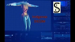 🩻​⚕️Imágenes DICOM 🩺​🚑​ Características y visualización [upl. by Nillek]