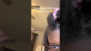 I lost so many locs because of this But the journey continues Updates on my channel locs [upl. by Madoc148]