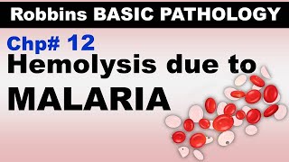 Ch12  Hemolysis due to MALARIA  Blood Pathology  Dr Asif Lectures [upl. by Billat]