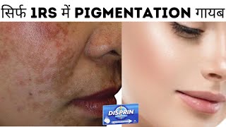 Disprin Tablets For Skin Freshness and Antiacne  How To Use Disprin  1Rs में pigmentation गायब [upl. by Clippard358]