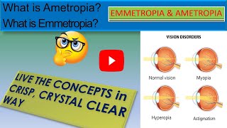 WHAT IS EMMETROPIA  WHAT IS AMETROPIA [upl. by Cromwell]