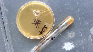 Cladosporium spp   Mycology [upl. by Floro]