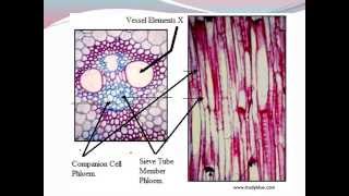 IGCSE 27 Translocation [upl. by Silecara]