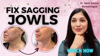 Sagging Jowls Dermatologists Secrets for a Tight Jawline Without Surgery [upl. by Ssac]