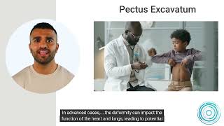 Pectus Excavatum [upl. by Arahset]