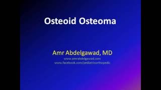 osteoid osteoma [upl. by Einial]