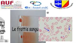 MORPHOLOGIE EN HEMATOLOGIE EPISODE 6 [upl. by Annaegroeg]