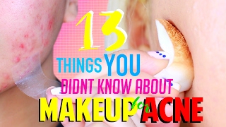 13 Things You NEVER Knew About MAKEUP for ACNE Skin [upl. by Ayanat49]