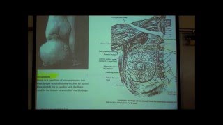 ANATOMY LYMPHATIC SYSTEM by Professor Fink [upl. by Salahcin]