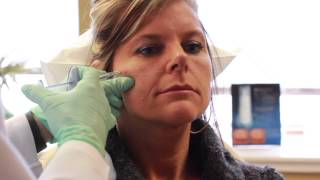 Juvederm Voluma XC Demonstration [upl. by Naujahs691]