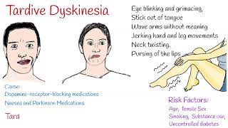 Tardive dyskinesia Causes Symptoms and Treatment [upl. by Eiralav]