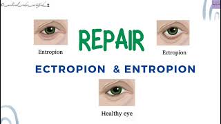 REPAIR ECTROPION amp ENTROPION CPT TOPICS MEDICAL CODING AND BILLING medicalcodercertified [upl. by Naed]