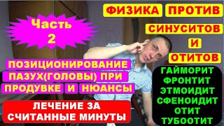 СИНУСИТ И ОТИТЫ Часть 2 ПОЗИЦИОНИРОВАНИЕ ПАЗУХ Лечение методом самопродувки [upl. by Tnarud]