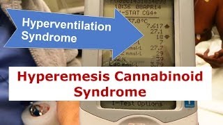 Hyperventilation Syndrome and Hyperemesis Cannabinoid Syndrome [upl. by Leatri]