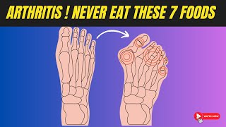 Arthritis Warning NEVER Eat These 7 Foods😱  Arthritis Causing Foods [upl. by Analram]