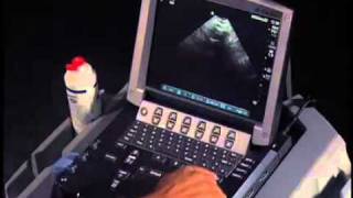 How To Transabdominal View of the Female Pelvis with Ultrasound [upl. by Airtemad]