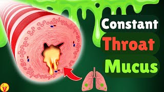 6 Real Causes of Phlegm amp Mucus in Your Throat Stop Constant Throat Clearing  VisitJoy [upl. by Suirtimid]