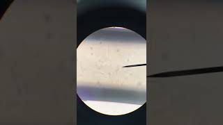 Heartworm under microscope Dirofilaria immitis Veterinary Video [upl. by Davina]