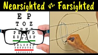 Myopia vs Hyperopia vs Presbyopia  Difference Explained [upl. by Buckler]