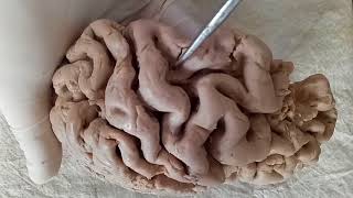 NEUROANATOMY  CEREBRAL CORTEX PART1 SULCI AND GYRI  BY DR MITESH DAVE [upl. by Ivatts624]