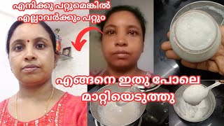 കറുത്ത മുഖവു൦ കരിമ൦ഗലൃവു൦ മാറ്റിയത് ഇങ്ങനെയാണ്how to make pigmentation face pack തെളിവ് സഹിത൦ [upl. by Lahpos]