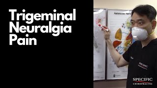 Trigeminal Neuralgia Pain Relief by Dr Suhs Facial Pain Treatment at Specific Chiropractic NYC [upl. by Oinotnaesoj151]