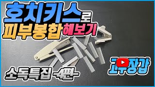 의료용 스테이플러skin stapler 피부 봉합 소독특집 4편 [upl. by Hentrich]