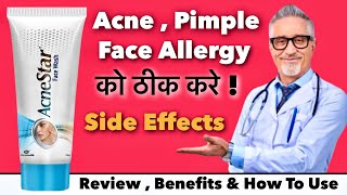 Acne Star Face Wash Review  Benefits amp How To Use [upl. by Nyletac]