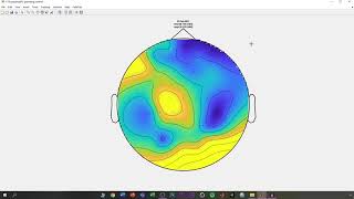 Análisis de electroencefalograma EEG  Curso online neurociencia [upl. by Holmes]