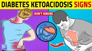 Diabetic Ketoacidosis Warning Signs You Should Know [upl. by Analihp]