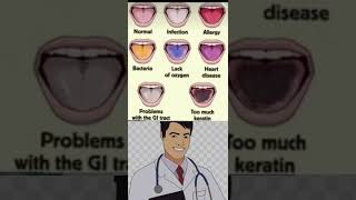 Check ✅ your tongue health shorts youtubeshorts [upl. by Thorner193]