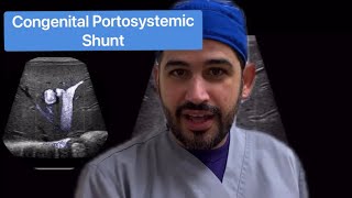 Congenital Portosystemic Shunt [upl. by Croom]