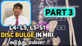 L4L5 and L5S1 Disc Bulge in MRI Whats Next Part 2 with Dr Vijayaraghavan in Tamil [upl. by Ajnek838]