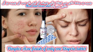 Pimples Acne finish of only one Disprin tabletNeat and clean skinKOMAL beauty voice [upl. by Sweet]