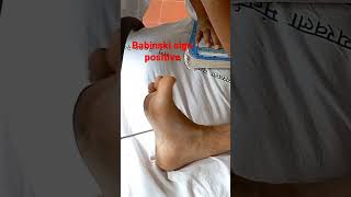 Plantar reflex  Babinski sign positive medicine medicineclinical cns mbbsmotivation mbbs [upl. by Voletta]