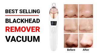 Best Blackhead Remover Vacuum Review and Buying Guide [upl. by Arber221]