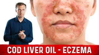 Why Use Cod Liver Oil for Eczema Remedies for Eczema – Dr Berg [upl. by Edbert]