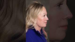 NO MORE Saggy Neck amp Jowls Facelift Transformation to Get Rid of Jowls [upl. by Jariah]