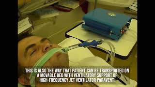 Mechanical ventilation with high frequency jet ventilation with endoscopic cannula [upl. by Ollayos]