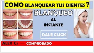 BLANQUEA TUS DIENTES AL INSTANTE PRUEBA EL REMEDIO CASERO [upl. by Clintock]