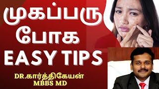 How to remove pimple easily  Tips by Doctor in Tamil  mugaparu poga tips [upl. by Suoivatco]