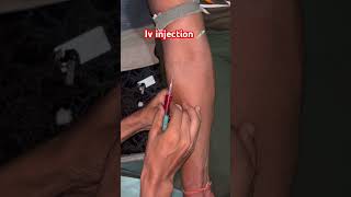 Iv injection viralvideo li [upl. by Giliane516]