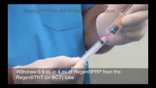 Preparing PRP for the OShot® [upl. by Koziel]