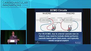 CVI2018 Session When to use hemodynamic support amp device selection  Ajay Kirtane MD [upl. by Jaynell]