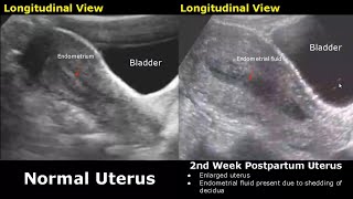 Gynecological amp Obstetric Ultrasound Normal Vs Abnormal Scan  Uterus Ovary Cervix Pregnancy USG [upl. by Concoff]