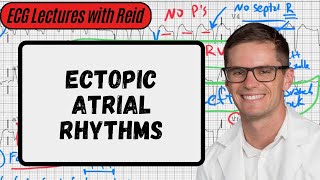 Ectopic Atrial Rhythms  Day 10 ECG Challenge [upl. by Akeihsat]