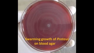 Proteus Swarming growth and its reason occuring so [upl. by Adnawaj]