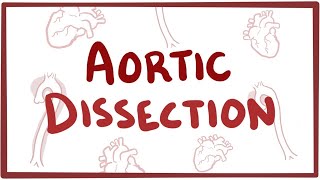 Aortic Dissection  causes symptoms diagnosis treatment pathology [upl. by Teerprug]