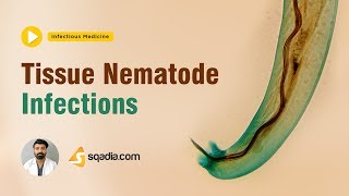 Tissue Nematode Infections  Medicine Lectures  Medical Student Online  VLearning [upl. by Rehpoitsirhc274]