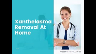 Home Remedy For Xanthelasma  Finally Easy Xanthelasma Removal At Home With Xanthel ® [upl. by Adnofal]